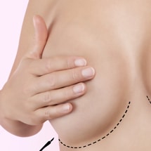 Signature Plastic & Reconstructive Surgery - Dr. Melissa Marks - breast implants - Plastic Surgeon Palm Beach Gardens
