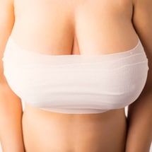 215x215_breast_reduction Signature Plastic & Reconstructive Surgery - breast - breast reduction